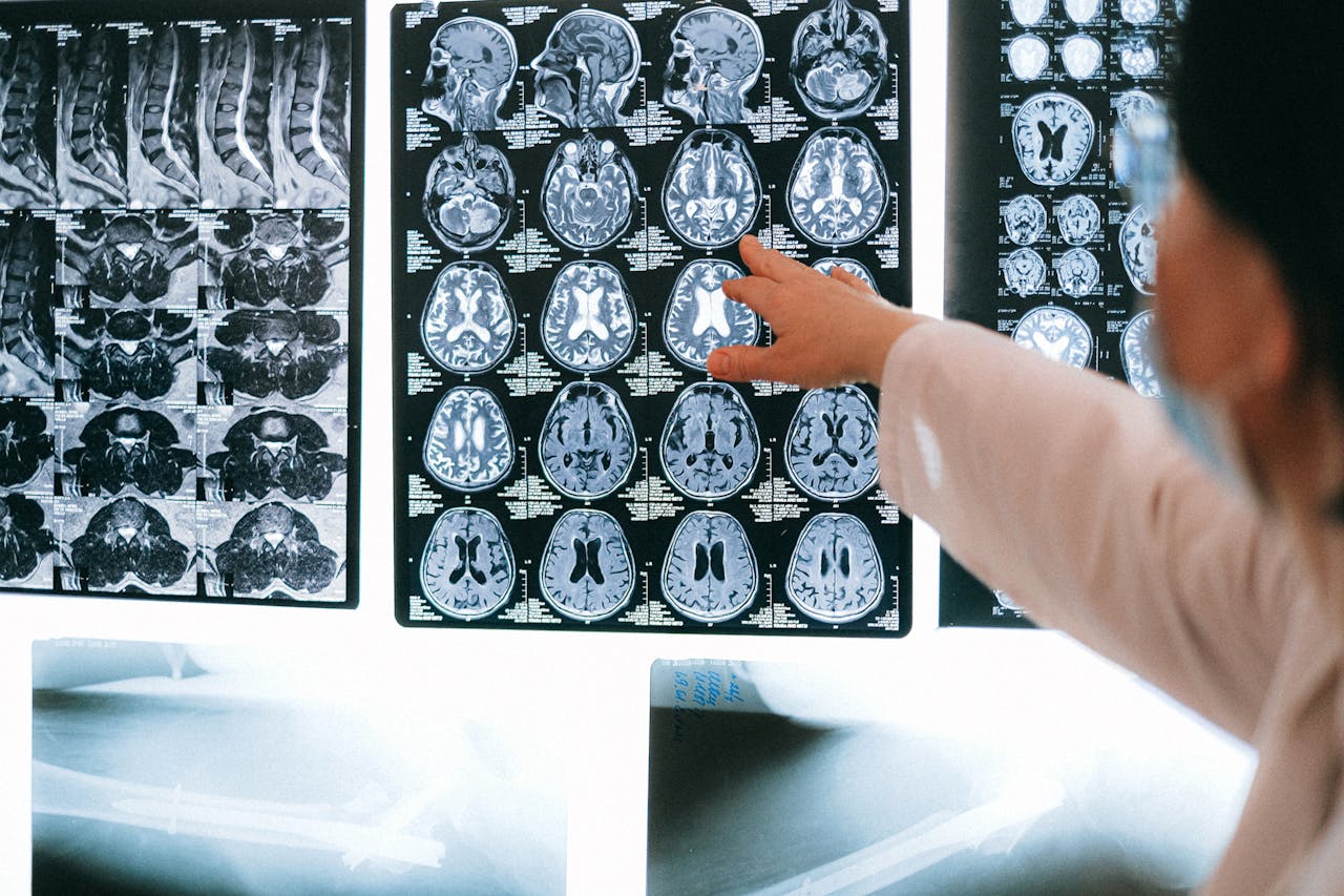 Brain & Nerve Wellness Package
